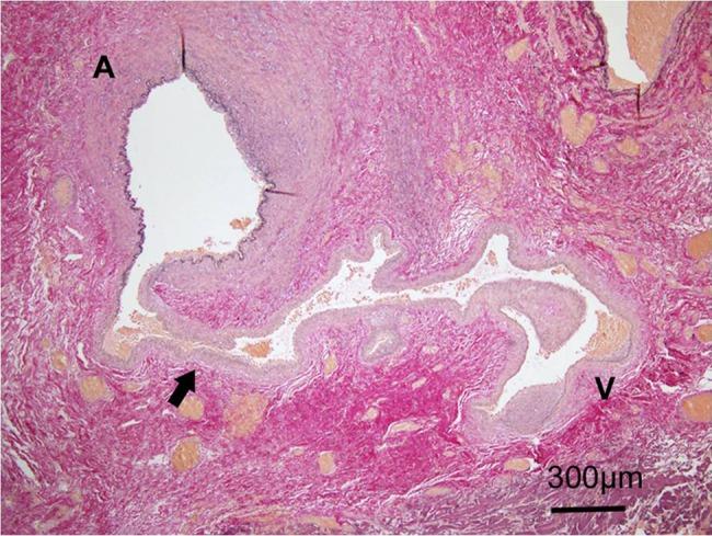 https://cdn.ncbi.nlm.nih.gov/pmc/blobs/57f6/4690004/69b97abe8839/rjv15604.jpg