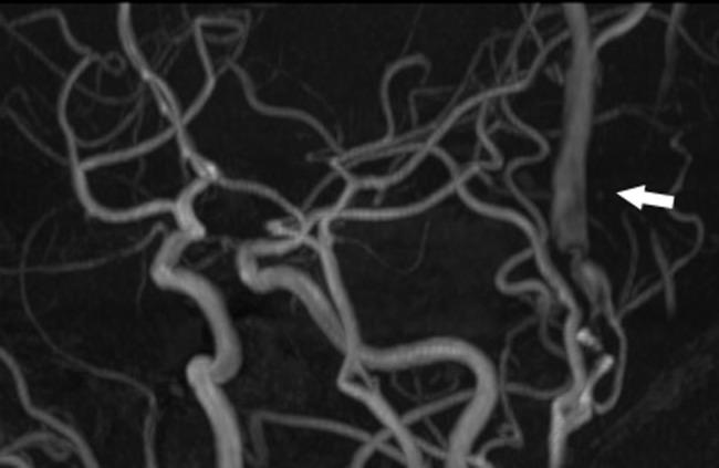 https://cdn.ncbi.nlm.nih.gov/pmc/blobs/57f6/4690004/f76f291877c0/rjv15601.jpg