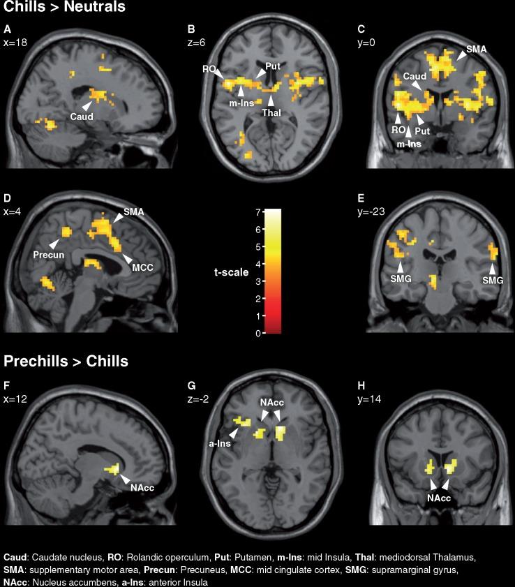 https://cdn.ncbi.nlm.nih.gov/pmc/blobs/57f6/5597896/91a91bf72527/nsx069f3.jpg