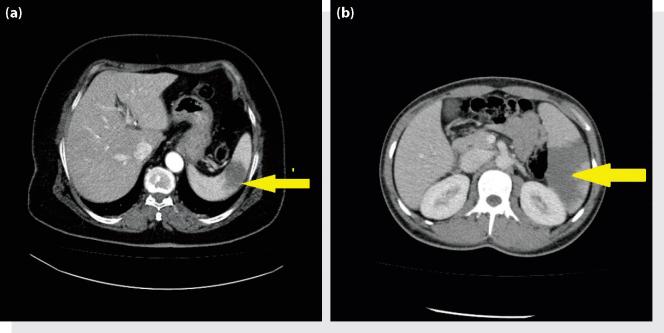 https://cdn.ncbi.nlm.nih.gov/pmc/blobs/57f7/4910014/31e657f681da/gr1.jpg