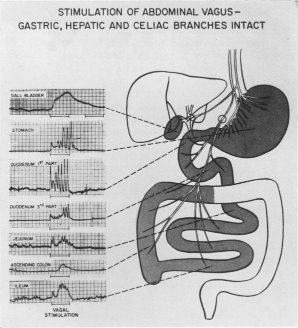 https://cdn.ncbi.nlm.nih.gov/pmc/blobs/57fa/1408393/5ce9690a71aa/annsurg00950-0133-a.jpg