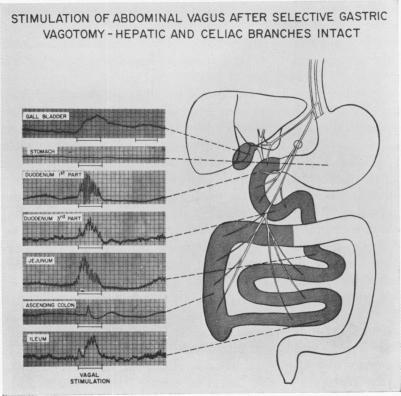 https://cdn.ncbi.nlm.nih.gov/pmc/blobs/57fa/1408393/a6aa67a2d9b7/annsurg00950-0134-a.jpg