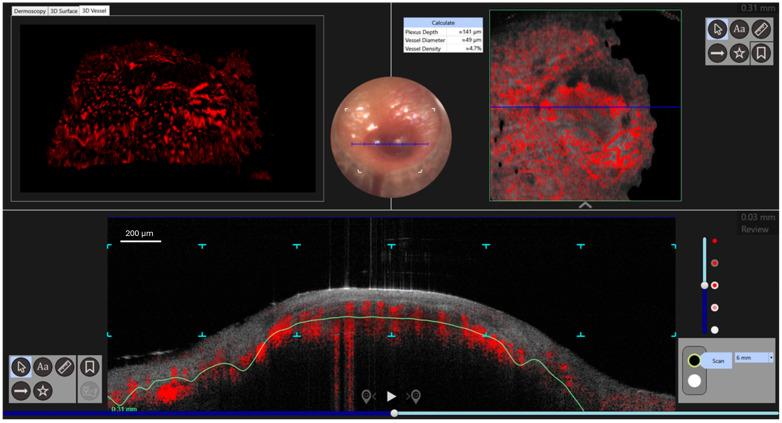 https://cdn.ncbi.nlm.nih.gov/pmc/blobs/5803/12249428/4f9e060e9492/diagnostics-15-01665-g003.jpg