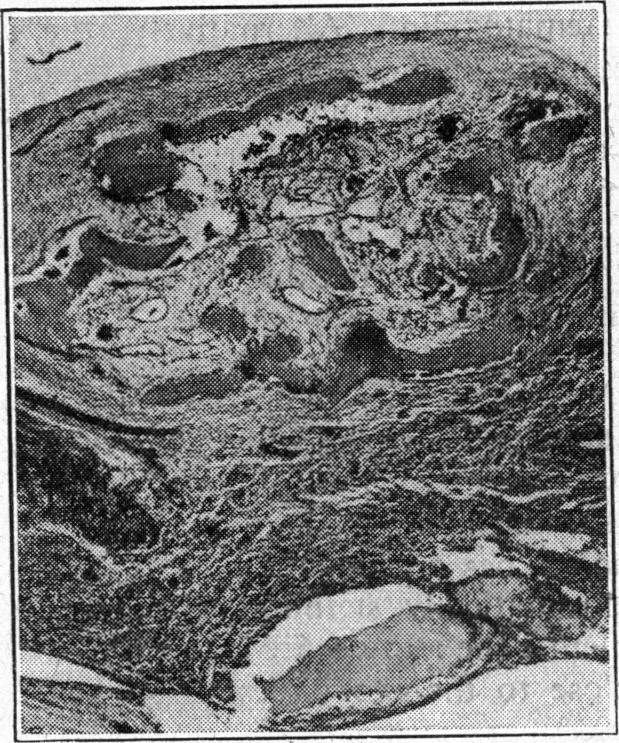https://cdn.ncbi.nlm.nih.gov/pmc/blobs/5805/2036464/0f2153d57432/brmedj03581-0015-b.jpg