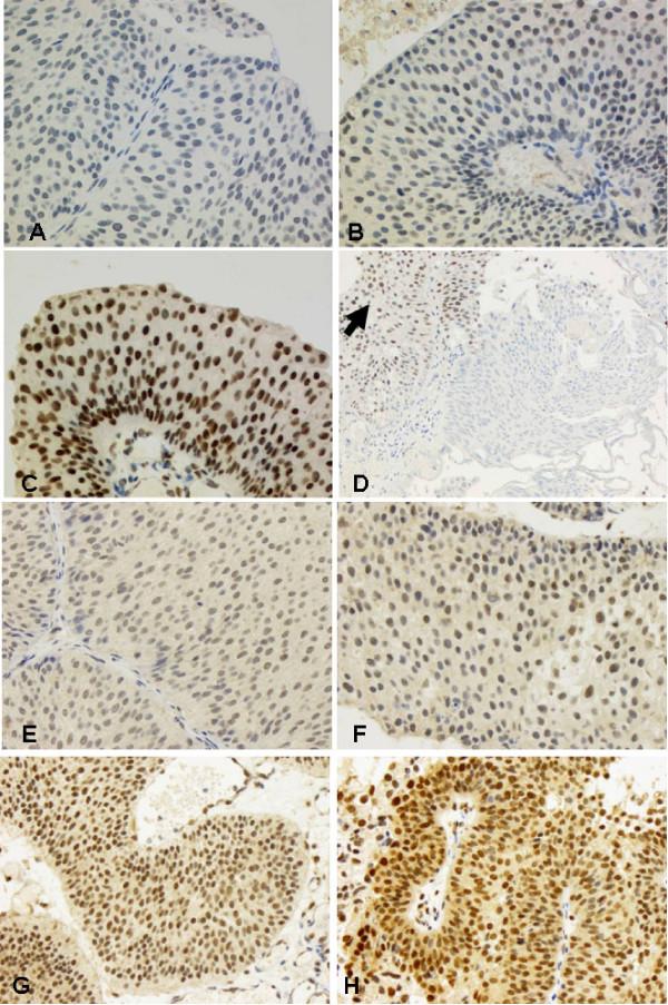 https://cdn.ncbi.nlm.nih.gov/pmc/blobs/5809/2631590/989b4c3bbe9c/1471-2407-8-369-3.jpg