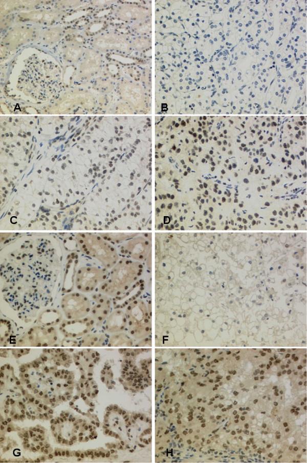 https://cdn.ncbi.nlm.nih.gov/pmc/blobs/5809/2631590/e74f1a020d9f/1471-2407-8-369-2.jpg