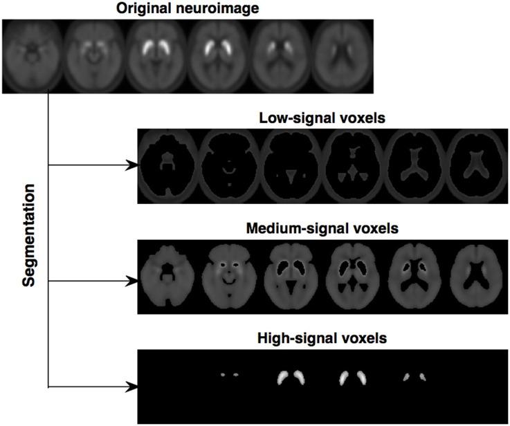 https://cdn.ncbi.nlm.nih.gov/pmc/blobs/580b/5640782/eb2987c80664/fnagi-09-00326-g0001.jpg