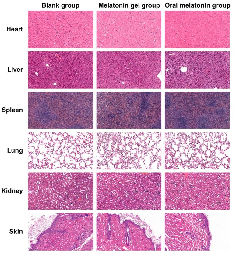 https://cdn.ncbi.nlm.nih.gov/pmc/blobs/580e/12191773/3e1182be21df/gels-11-00435-g007.jpg