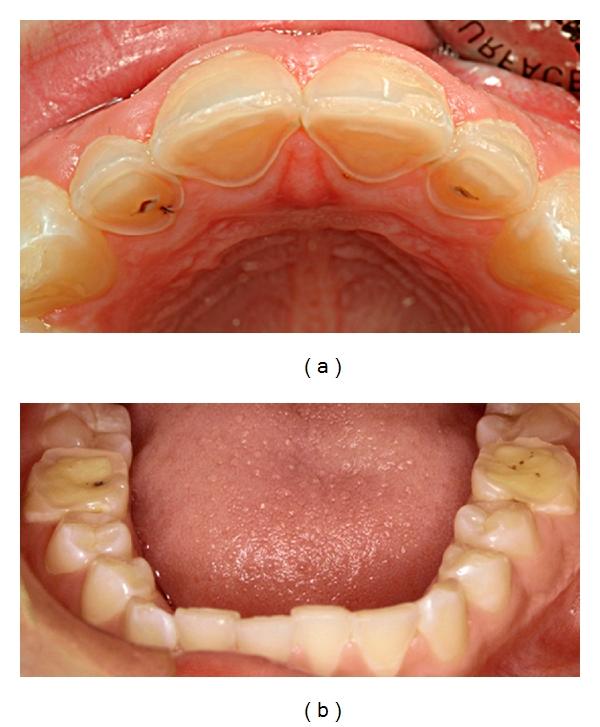 https://cdn.ncbi.nlm.nih.gov/pmc/blobs/580e/3312266/fed65bbb9106/IJD2012-632907.004.jpg