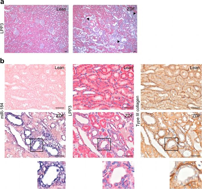 https://cdn.ncbi.nlm.nih.gov/pmc/blobs/580f/5423990/092322cc1ae5/125_2017_4248_Fig3_HTML.jpg