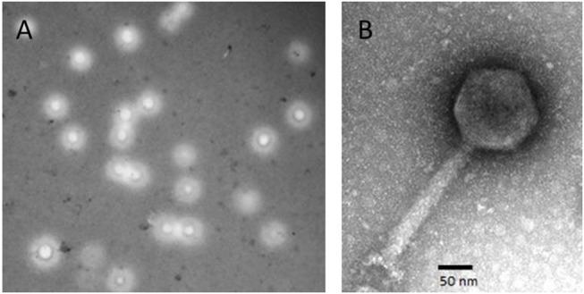 https://cdn.ncbi.nlm.nih.gov/pmc/blobs/5810/6207643/44d2b1ad968e/fmicb-09-02501-g0001.jpg