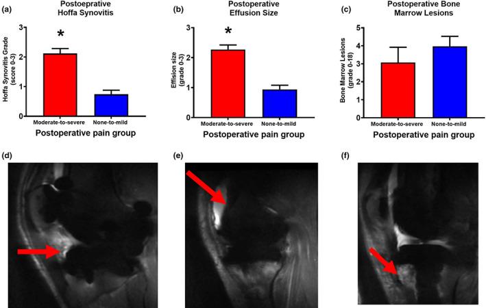 https://cdn.ncbi.nlm.nih.gov/pmc/blobs/5811/9544145/891846775f56/EJP-26-1979-g002.jpg