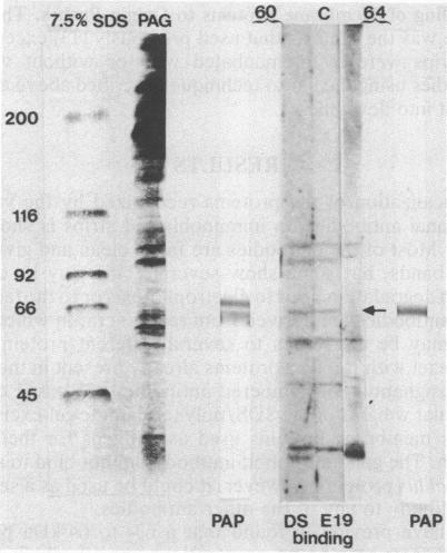 https://cdn.ncbi.nlm.nih.gov/pmc/blobs/5816/282209/221c074bffc3/pnas00299-0039-a.jpg