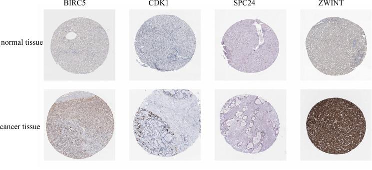 https://cdn.ncbi.nlm.nih.gov/pmc/blobs/5819/5696240/13aec9325dbb/oncotarget-08-93014-g003.jpg