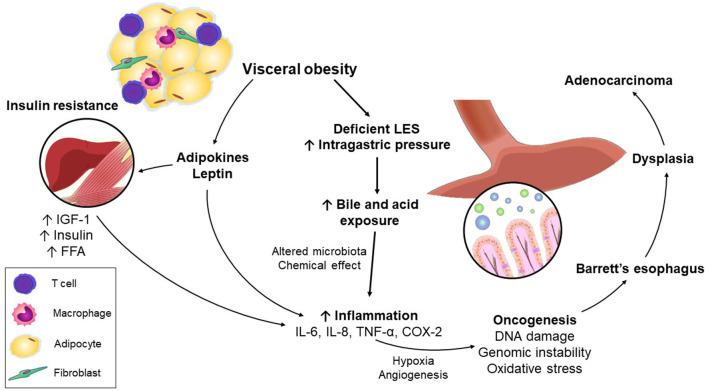 https://cdn.ncbi.nlm.nih.gov/pmc/blobs/5825/7994523/c3f7e51a2f84/fonc-11-627270-g0001.jpg
