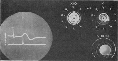 https://cdn.ncbi.nlm.nih.gov/pmc/blobs/582d/1896585/a6c8f5b4faeb/procrsmed00233-0068-a.jpg
