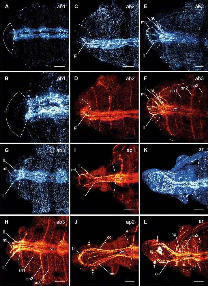 https://cdn.ncbi.nlm.nih.gov/pmc/blobs/5830/4657251/8c05abcf9ba6/40851_2015_23_Fig3_HTML.jpg