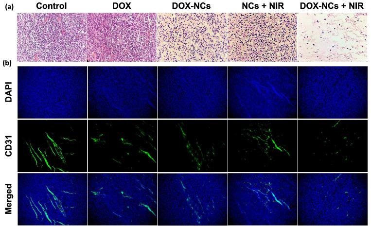 https://cdn.ncbi.nlm.nih.gov/pmc/blobs/5838/9194590/b34acdbaa621/ntnov06p0350g013.jpg
