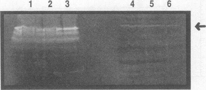 https://cdn.ncbi.nlm.nih.gov/pmc/blobs/583d/303314/fd23ccdd0207/iai00012-0456-c.jpg