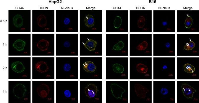https://cdn.ncbi.nlm.nih.gov/pmc/blobs/583f/5503489/b370878bfc8a/ijn-12-4773Fig9.jpg