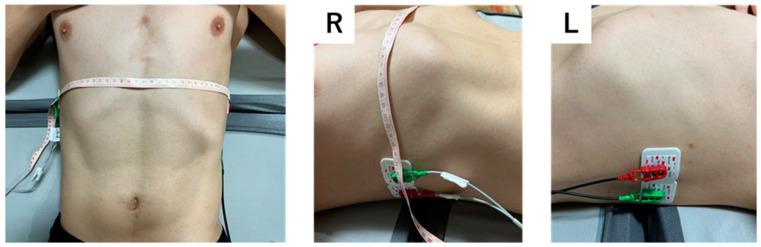 https://cdn.ncbi.nlm.nih.gov/pmc/blobs/5844/10380905/e91885b37dd2/jcdd-10-00291-g001.jpg
