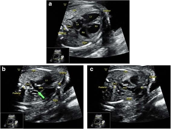 https://cdn.ncbi.nlm.nih.gov/pmc/blobs/5847/4928259/3e674f4eda22/12884_2016_933_Fig4_HTML.jpg