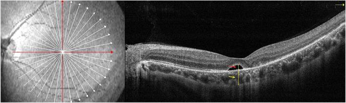 https://cdn.ncbi.nlm.nih.gov/pmc/blobs/5847/7885473/d4db3e1a745d/12886_2021_1853_Fig1_HTML.jpg