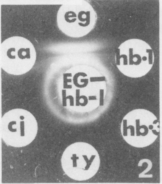 https://cdn.ncbi.nlm.nih.gov/pmc/blobs/584a/415031/6c31ec2c0e69/iai00229-0112-c.jpg