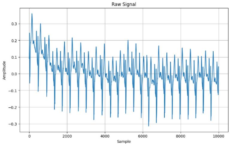 https://cdn.ncbi.nlm.nih.gov/pmc/blobs/5851/11680072/fa05cb410dc5/sensors-24-07926-g002.jpg