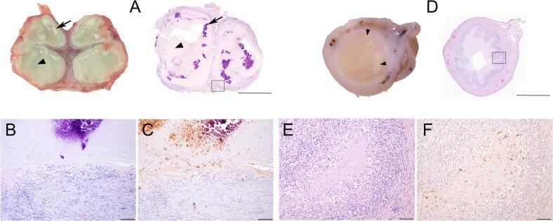 https://cdn.ncbi.nlm.nih.gov/pmc/blobs/5855/12088816/79d50c640979/gr3.jpg