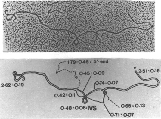 https://cdn.ncbi.nlm.nih.gov/pmc/blobs/5855/324111/c6ce19a0ed22/nar00429-0100-a.jpg