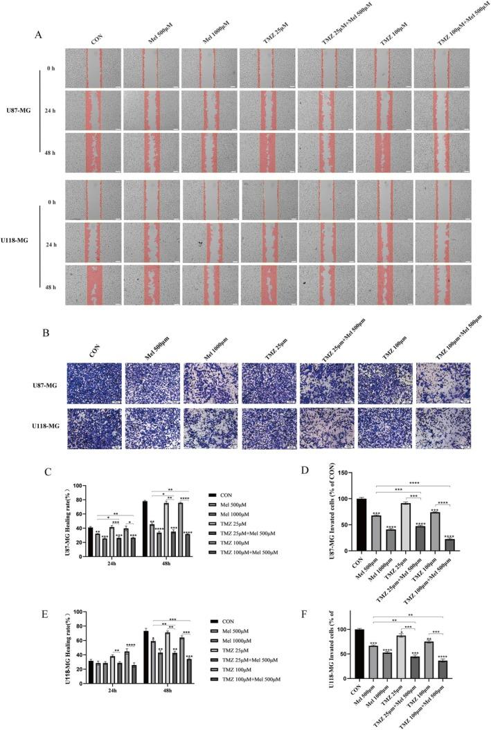 https://cdn.ncbi.nlm.nih.gov/pmc/blobs/5856/12350191/fe19d20a6e3b/JCMM-29-e70778-g004.jpg