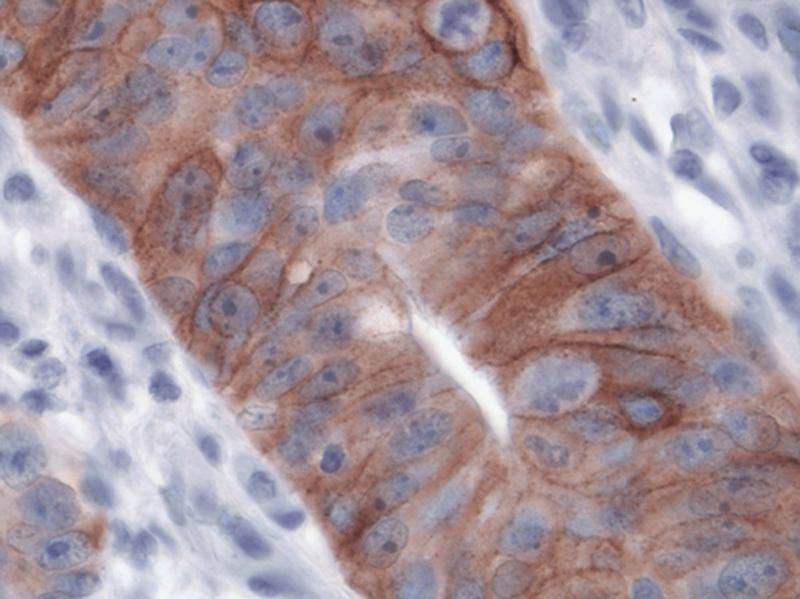 https://cdn.ncbi.nlm.nih.gov/pmc/blobs/5859/6135466/d35197736918/pai-26-539-g006.jpg