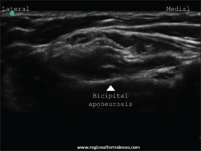 https://cdn.ncbi.nlm.nih.gov/pmc/blobs/585a/4541174/17368fc7beae/JOACP-31-296-g035.jpg