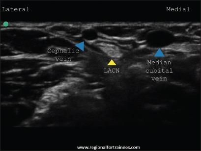 https://cdn.ncbi.nlm.nih.gov/pmc/blobs/585a/4541174/4caa2a0bb44d/JOACP-31-296-g036.jpg