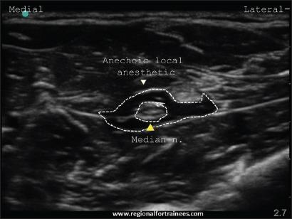 https://cdn.ncbi.nlm.nih.gov/pmc/blobs/585a/4541174/6a8be8e759c2/JOACP-31-296-g031.jpg