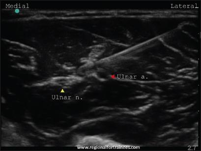 https://cdn.ncbi.nlm.nih.gov/pmc/blobs/585a/4541174/797538e42d87/JOACP-31-296-g021.jpg
