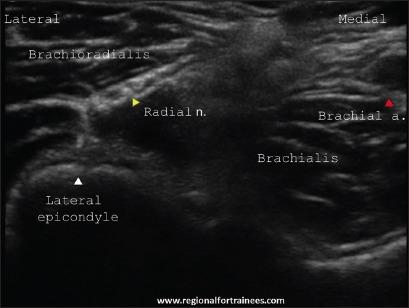 https://cdn.ncbi.nlm.nih.gov/pmc/blobs/585a/4541174/8e5bec60c2ec/JOACP-31-296-g009.jpg