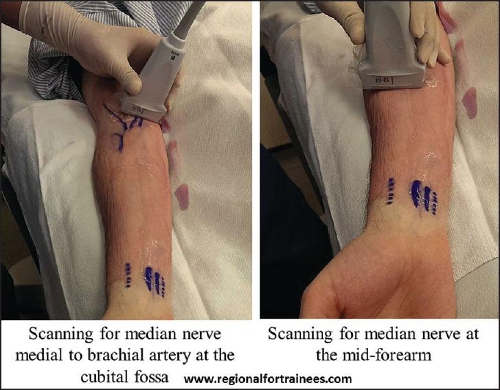 https://cdn.ncbi.nlm.nih.gov/pmc/blobs/585a/4541174/ccda12686af1/JOACP-31-296-g025.jpg