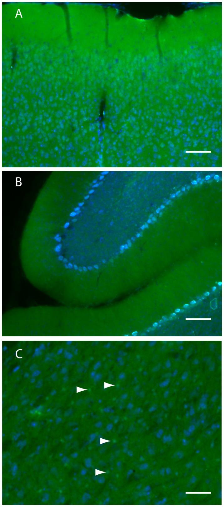 https://cdn.ncbi.nlm.nih.gov/pmc/blobs/5867/3994155/d989a553f9e7/pone.0095958.g003.jpg