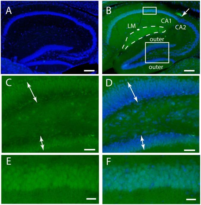 https://cdn.ncbi.nlm.nih.gov/pmc/blobs/5867/3994155/e51f093eac8d/pone.0095958.g002.jpg