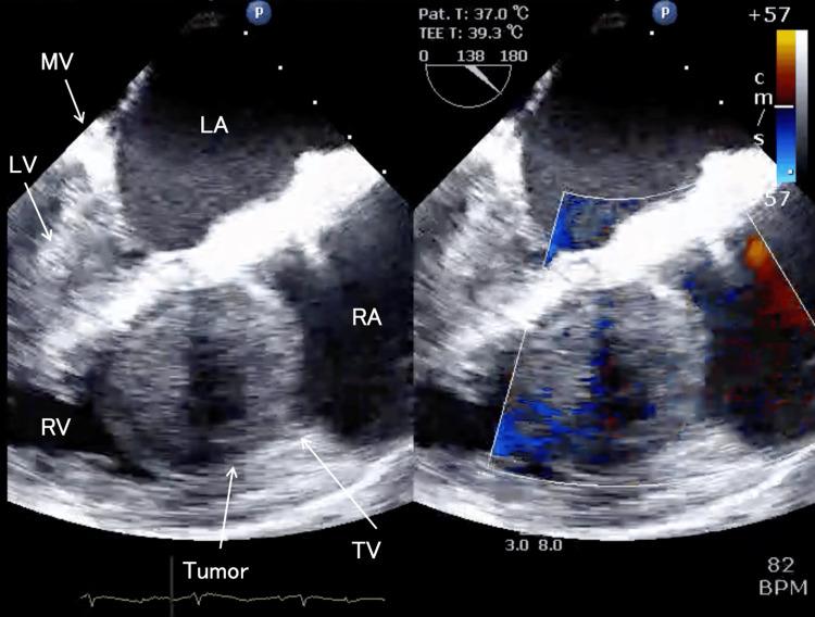 https://cdn.ncbi.nlm.nih.gov/pmc/blobs/586c/12133208/7d02f1cf5f55/cureus-0017-00000083435-i05.jpg