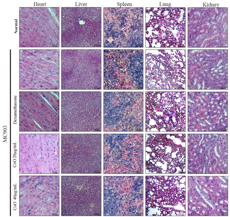 https://cdn.ncbi.nlm.nih.gov/pmc/blobs/5874/8878353/2e3a1302e308/nanomaterials-12-00638-g004.jpg