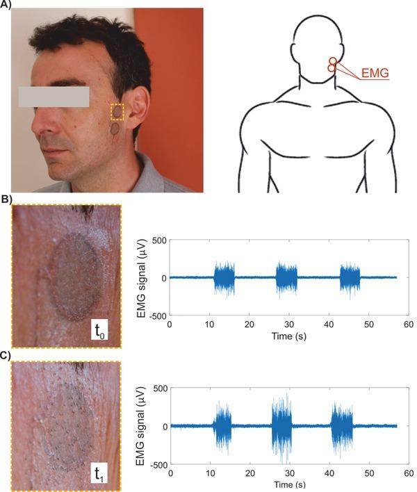 https://cdn.ncbi.nlm.nih.gov/pmc/blobs/5876/5867059/af188dcaf993/ADVS-5-1700771-g006.jpg
