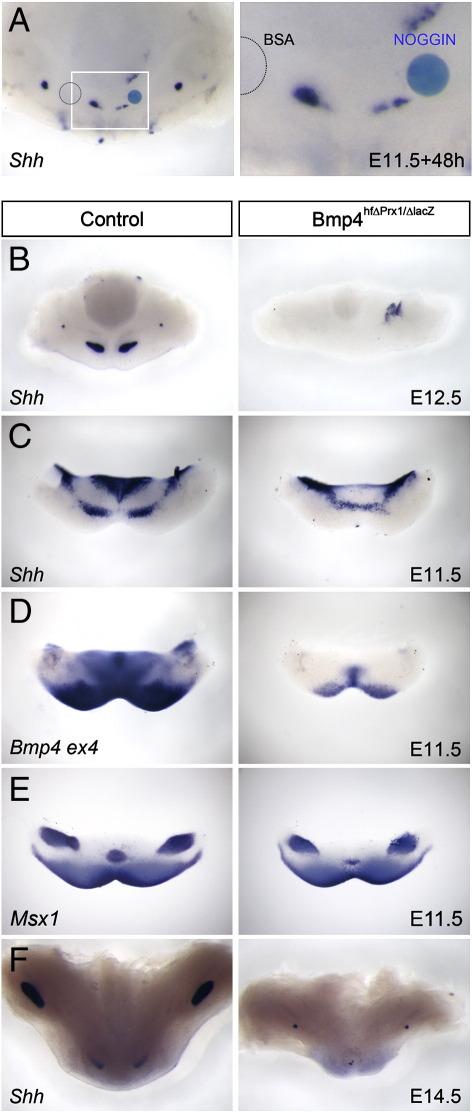 https://cdn.ncbi.nlm.nih.gov/pmc/blobs/5879/2997430/0059d0a58af2/gr4.jpg