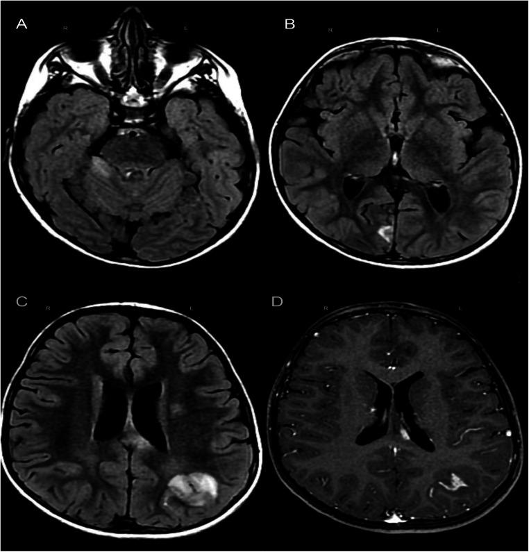 https://cdn.ncbi.nlm.nih.gov/pmc/blobs/587e/8115868/af20f98e45a1/10072_2021_5311_Fig1_HTML.jpg