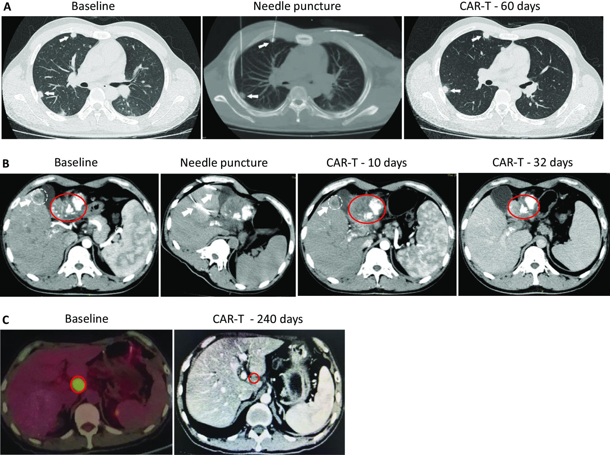 https://cdn.ncbi.nlm.nih.gov/pmc/blobs/5887/8323212/cbd51742b273/13045_2021_1128_Fig2_HTML.jpg