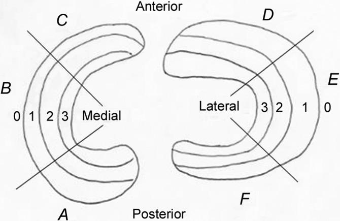 https://cdn.ncbi.nlm.nih.gov/pmc/blobs/5888/4714576/883d02325c9a/10.1177_2325967115611386-fig2.jpg