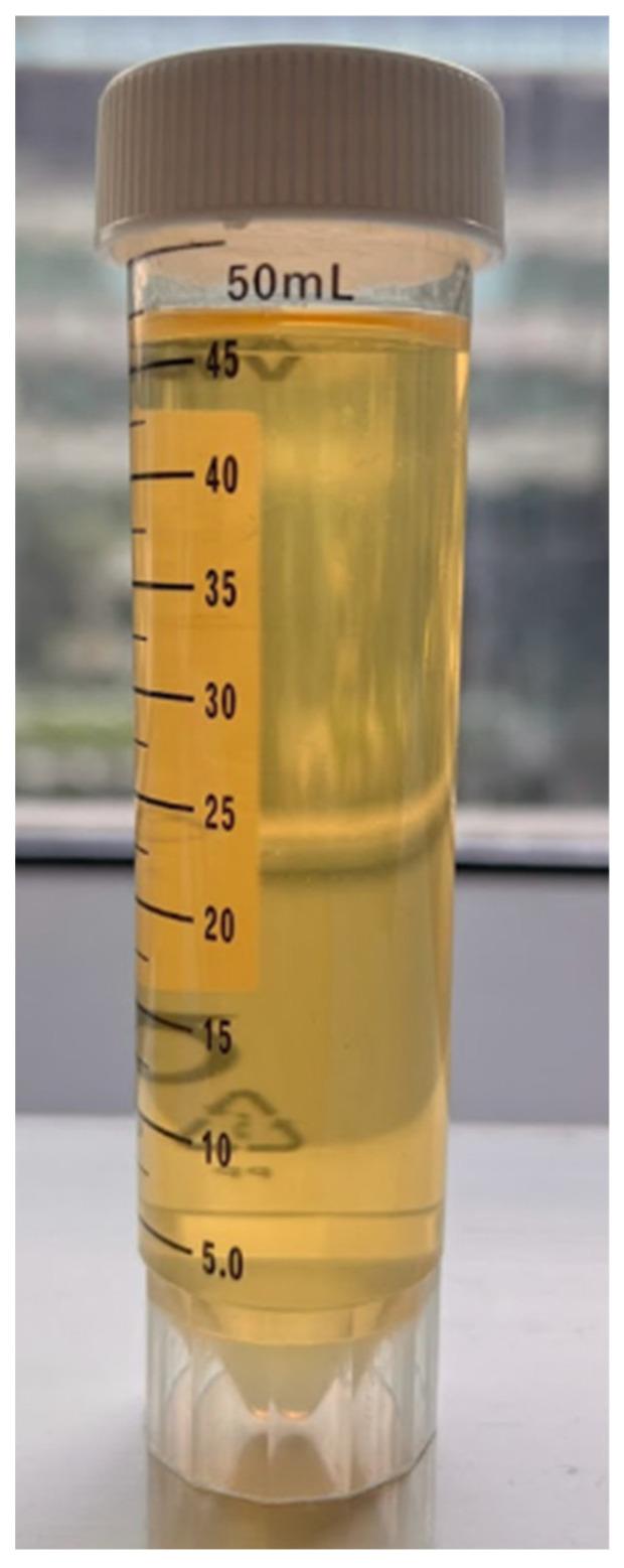 https://cdn.ncbi.nlm.nih.gov/pmc/blobs/588e/12191465/cd0c9562a7bb/gels-11-00457-g014.jpg