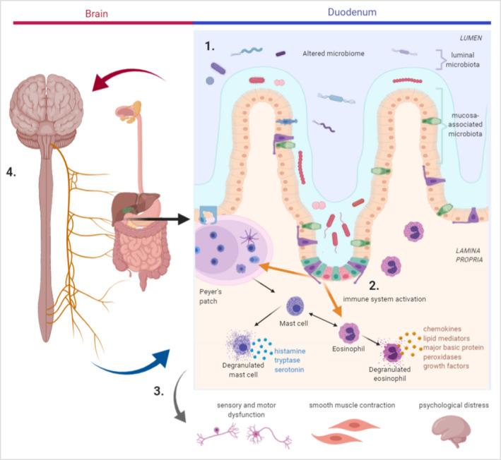 https://cdn.ncbi.nlm.nih.gov/pmc/blobs/588e/9786680/ce0d45260c75/NMO-34-e14372-g001.jpg